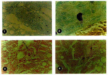 �ʴ�ϸ���ڸ���ά��������չ�����е����ü�����TNFa�Ĺ�ϵ