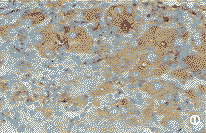 ���͸��׻��߸���֯��Bcl-2��Bax��Bak�ı��Ｐ����