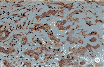 ���͸��׻��߸���֯��Bcl-2��Bax��Bak�ı��Ｐ����