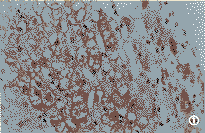 p16��CDK4��Rb���˸�ϸ�����еı���