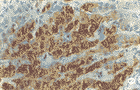 p16��CDK4��Rb���˸�ϸ�����еı���