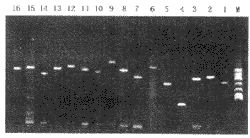 HLA-DRB�����̬���뷢����˯��