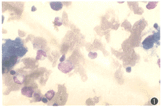 ������֯ϸ������֢һ������