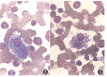 ������֯ϸ������֢һ������