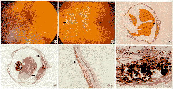 ����ĤѪ�������ﲡ�����ٴ�����ѧ����