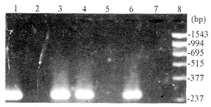 ������ṹ����ԭ��⿹���͸��ײ���IgM���巽���Ľ���