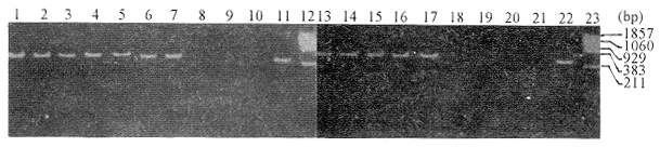 ��Ѫ����ֽƬ��������ȱ�ݲ���1��ǰ��������ļ��