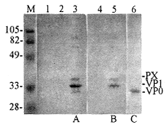 ���͸������鶻�粡���ڼ���ϸ���ܸ����Ӵ�ȴ������HAV��ԭ