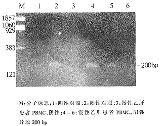��ʽPCR��ԭλ�ӽ��������β�����
������ϸ����TTV DNA