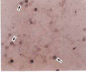 ��ʽPCR��ԭλ�ӽ��������β�����
������ϸ����TTV DNA