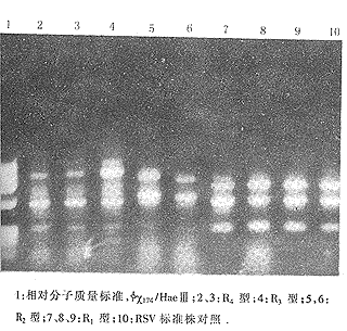 Ӥ�׶��������ϰ�������Ⱦ�������в�ѧ�о�