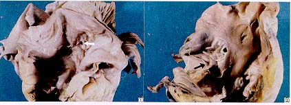 ��43���������������