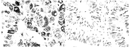 �ӹ���Ĥ��P16�����������֯��ѧ�۲�