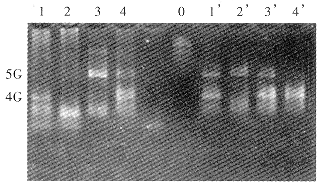 Ѫ������øԭ�������������ӻ��������Ӷ�̬����2�����򲡰鷢���Ĳ��Ĺ�ϵ