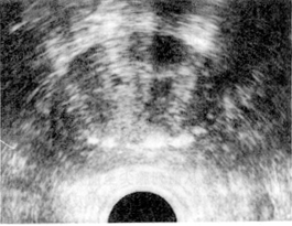 ǰ��������֢ǻ��B������������������ָ������ػع����