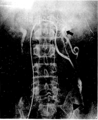 ͬ���ܾ�ƤԶ��Ӳ��˨�����ƾ�����������