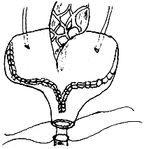 ������ѹ�ɿ��Իس���������