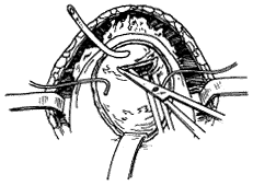 �ܹǺ�˳��ǰ���ٰ�������(��16������)