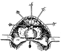 �ܹǺ�˳��ǰ���ٰ�������(��16������)