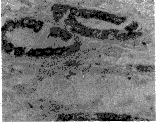 ICE�������еı��Ｐ��ϸ�������ʵĹ�ϵ