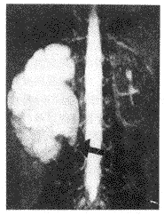 MRU ��С��������Ƽ�����ϵ�����