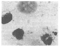 VP-16�յ�PC-3ϸ��������p53���������о�