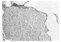 Fas�����ڰ��װ��еı��Ｐ����