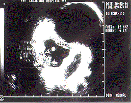 <doctitle>���ھ�΢����̽ͷ��ʳ�ܼ�������ϼ�ֵ</doctitle>