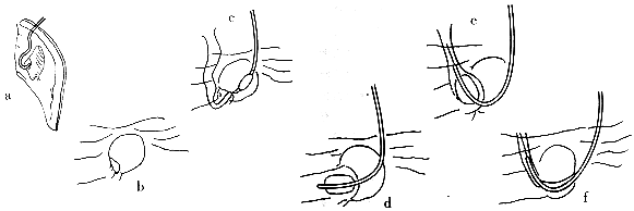 ��ͷ�����һ���ѡ���Ե��ܲ�ܵķ���