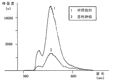 �����շ��󳦶�����������ӫ����׷���