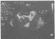 ��ʳ�ܳ��������������������Ҷʽ��ļ�ֵ