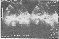 ��ȫ��ˮ��״̥���빬��������������̥������1��