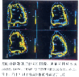 Color Kinesis��ʶ���Ĺ������ļ����жϹ��������Ӧ���о�