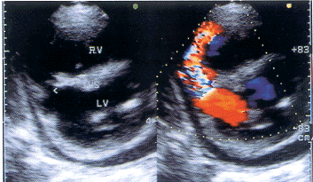 ��ɫ�����ճ�����ϼ����ļ��������Ҽ������1��