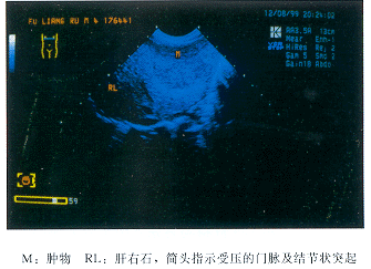 ���ܰ͹����������Խ���Ը�Ӳ��1��