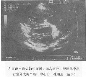 ˫ǻ�����Һϲ��Ҽ��ȱ��1��