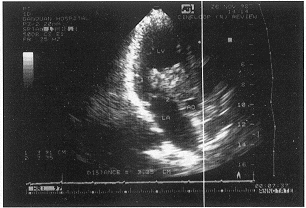 ����������ճҺ��������������1��