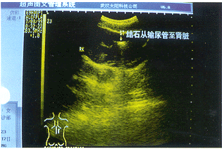 B����϶�̬���������ʯ1��306