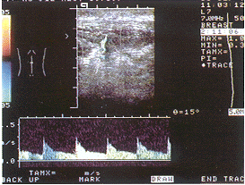 B���������������ά��1��