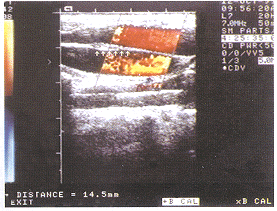 �ʳ���Ͼ��ھ������Ų��ظ�����1��