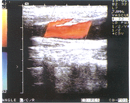 �ʳ���Ͼ��ھ������Ų��ظ�����1��