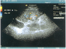 ��ɫ������Ѫ������Լ����缫��Ƶ���Ƹΰ���Ч���۲�