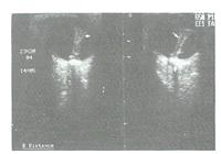 ��������ԭ���Բ���������֢1��