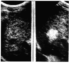 ��������ע����ˮ�ƾ����Ƹΰ��������о�