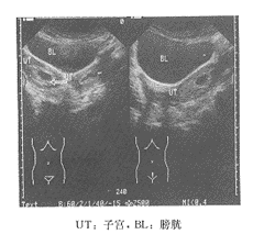 B�ͳ������˫���ӹ�˫���������׷�˾ͪҩ������1��