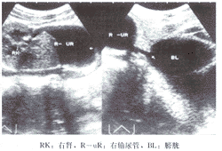 �����������������ת������������ܼ��俪��λ���쳣1��