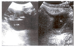 �����������������ת������������ܼ��俪��λ���쳣1��