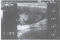 ���������λ����1��