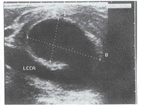 ��ɫ�����ճ�����Ͼ��������Զ�����1��