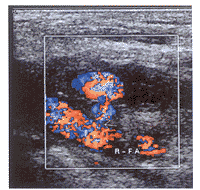 ��������ѹ�չɶ������Զ�����1��